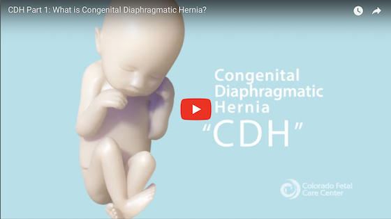 What is CDH?